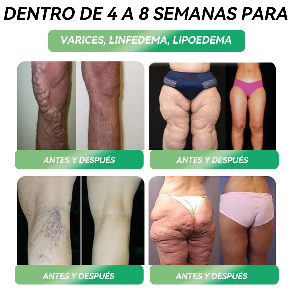 🏥𝐑𝐞𝐜𝐨𝐦𝐞𝐧𝐝𝐚𝐝𝐨 𝐩𝐨𝐫 𝐔𝐧𝐢𝐯𝐞𝐫𝐬𝐢𝐝𝐚𝐝 𝐝𝐞 𝐁𝐚𝐫𝐜𝐞𝐥𝐨𝐧𝐚, 𝐄𝐬𝐩𝐚ñ𝐚 | 𝐓𝐢𝐞𝐧𝐝𝐚 𝐨𝐟𝐢𝐜𝐢𝐚𝐥 | 🍀𝑆𝑇𝐷𝐸𝐼® 𝐺𝐿𝑃-1  𝑃𝑒𝑠𝑜 𝑃é𝑟𝑑𝑖𝑑𝑎 𝑂𝑟𝑎𝑙 𝑆𝑜𝑙𝑢𝑐𝑖ó𝑛 - 👨‍⚕️ 𝑂𝑏𝑒𝑠𝑖𝑑𝑎𝑑, 𝑒𝑛𝑓𝑒𝑟𝑚𝑒𝑑𝑎𝑑𝑒𝑠 𝑐𝑎𝑟𝑑𝑖𝑜𝑣𝑎𝑠𝑐𝑢𝑙𝑎𝑟𝑒𝑠, 𝑑𝑖𝑎𝑏𝑒𝑡𝑒𝑠, 𝑎𝑝𝑛𝑒𝑎 𝑑𝑒𝑙 𝑠𝑢𝑒ñ𝑜, 𝑝𝑟𝑜𝑏𝑙𝑒𝑚𝑎𝑠 𝑎𝑟𝑡𝑖𝑐𝑢𝑙𝑎𝑟𝑒𝑠 𝑦 𝑚á𝑠
